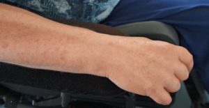medical taping - ms ohne Tape