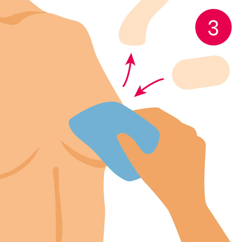 Wiederanbringen des boob tapes